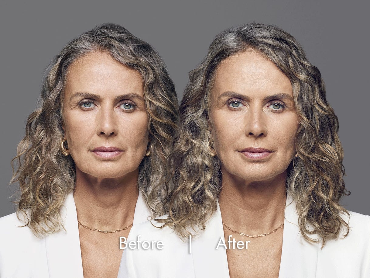 Before and after results